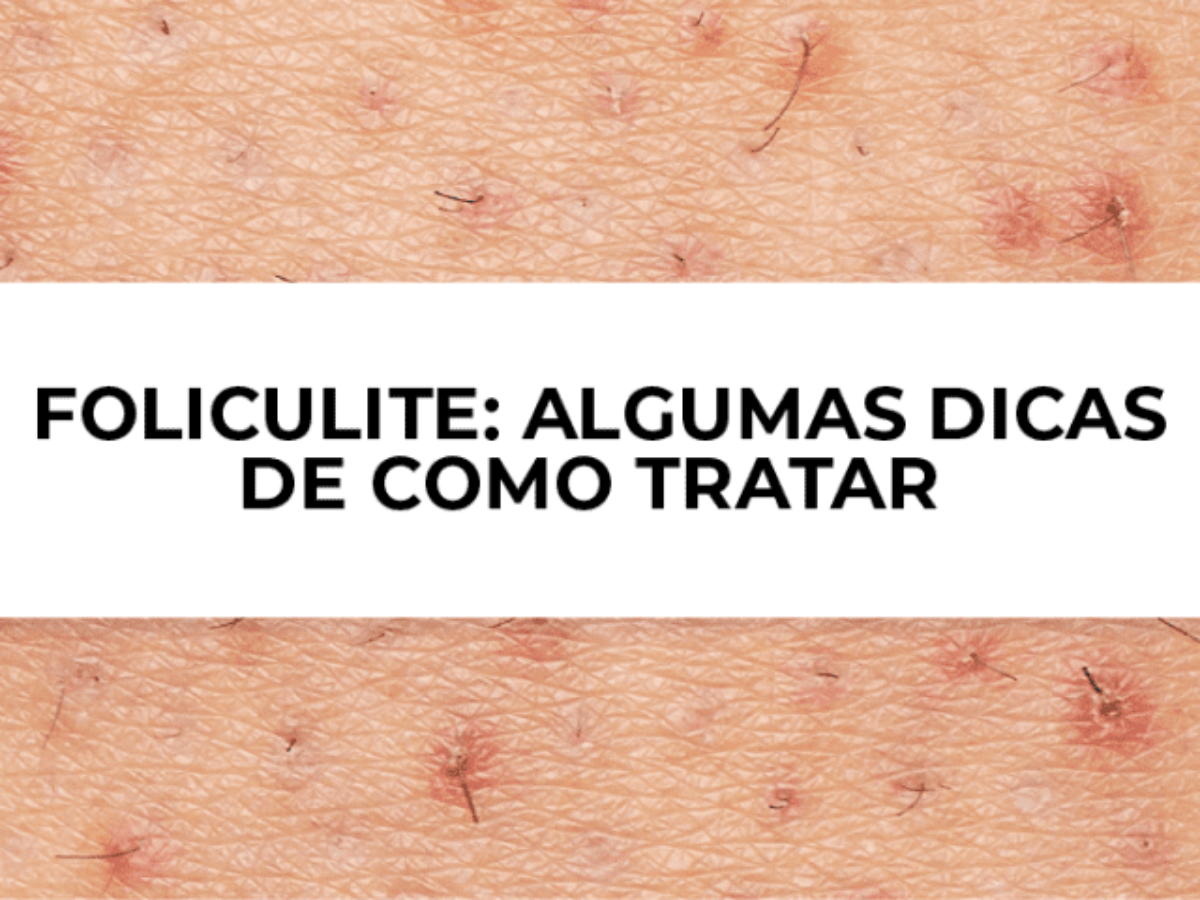 como tratar foliculite