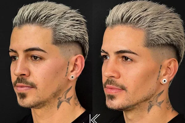 erros ao tentar o corte do Biel