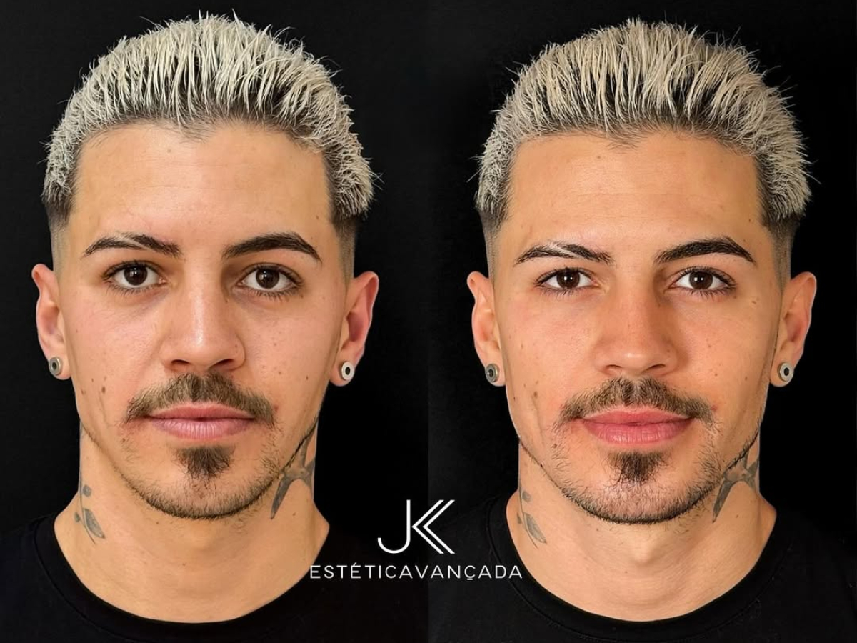 corte Biel vs corte outro cantor