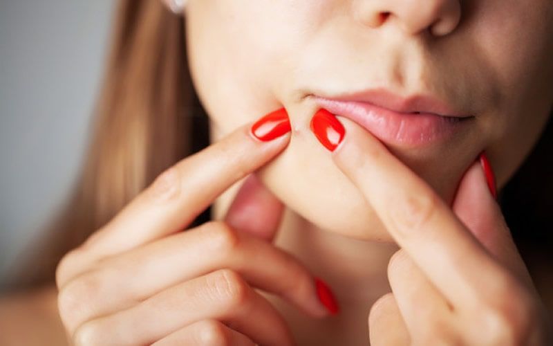 Diferença entre cravo-da-índia (especiaria) e cravos na pele