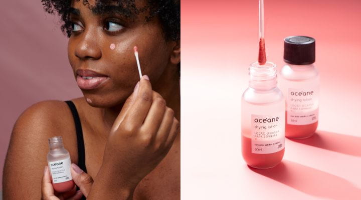 Como identificar e tratar diferentes tipos de espinhas