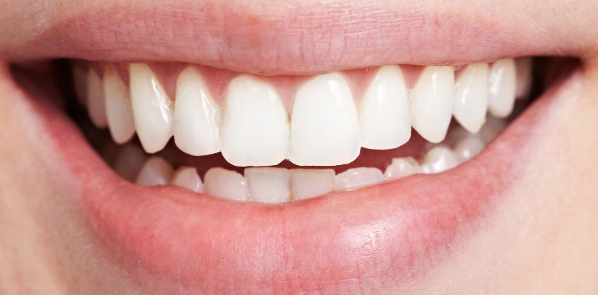 Os 5 pilares para um sorriso perfeito e saudável