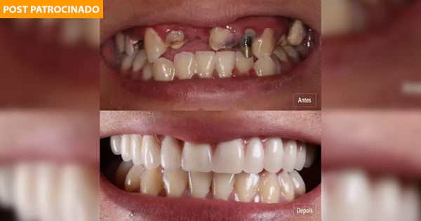 Os 5 pilares para um sorriso perfeito e saudável