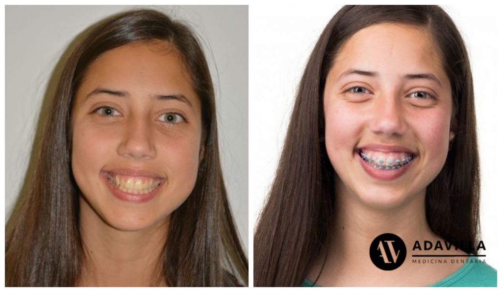 Alimentação e saúde bucal: o que você precisa saber