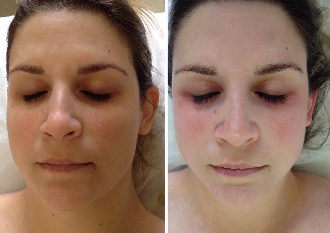 Detox Facial Caseiro: Guia Passo a Passo para uma Pele Radiante