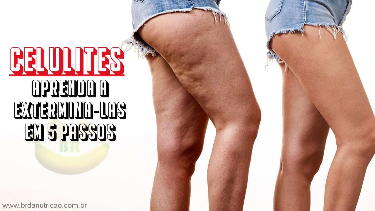 dicas para acabar com a celulite