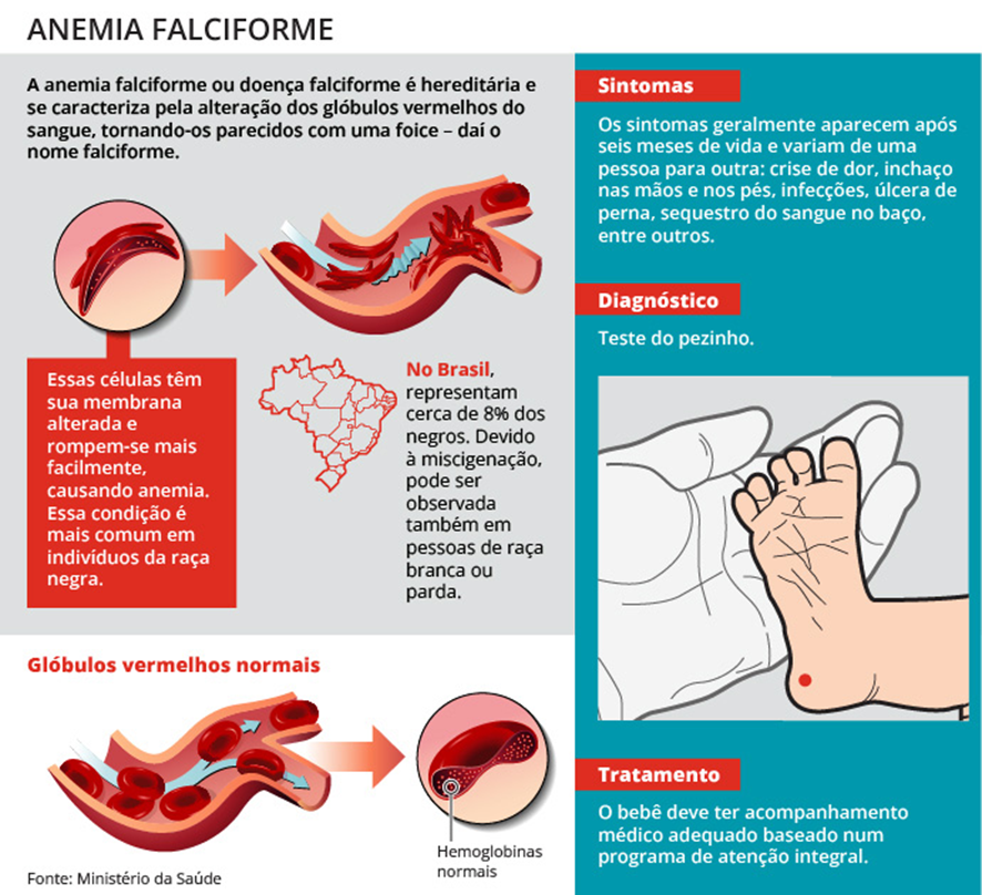 Doença Falciforme: Entendendo os Sintomas e o Impacto no Dia a Dia