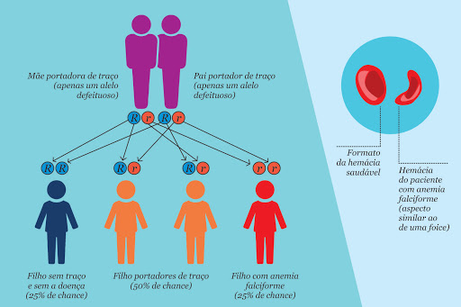 Guia Completo: Diagnóstico e Tratamento da Doença Falciforme no SUS