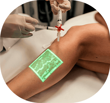 CLaCS: O Padrão-Ouro no Tratamento de Vasinhos e Varizes