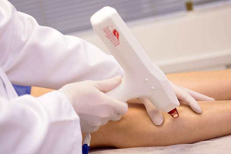 Escleroterapia a Laser vs. Convencional: Qual a Melhor Opção para Você?