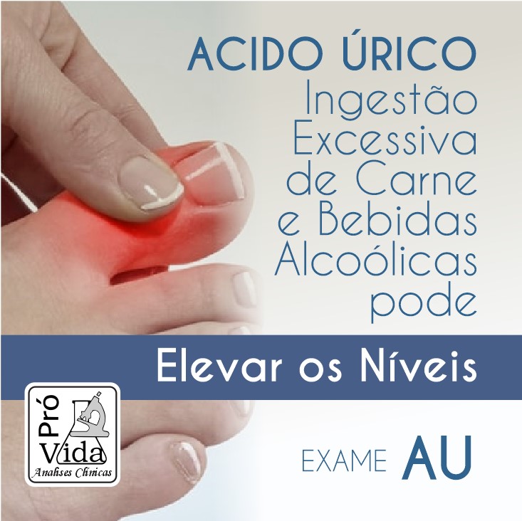 5 ideias de títulos:
1. Ácido Úrico: Entenda os Sintomas e a Importância do Exame.
2. Gota e Cálculos Renais: Como o Exame de Ácido Úrico Ajuda no Diagnóstico.
3. Preparo para o Exame de Ácido Úrico: Jejum e Coleta Explicados.
4. Valores de Referência do Ácido Úrico: O Que Significa Estar Acima ou Abaixo?
5. Ácido Úrico na Gravidez: Rastreamento de Pré-eclâmpsia.