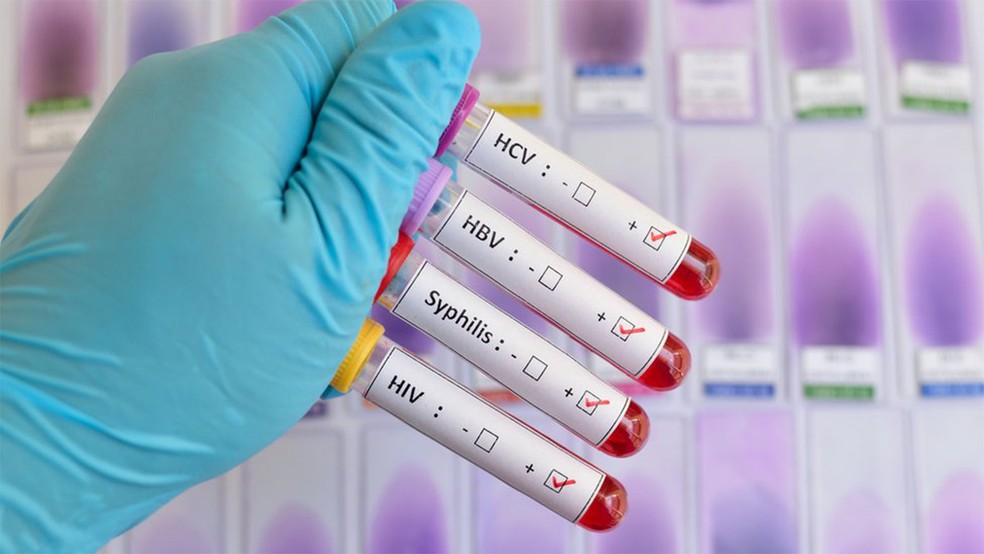 Sintomas Comuns de ISTs e Quando Procurar um Médico