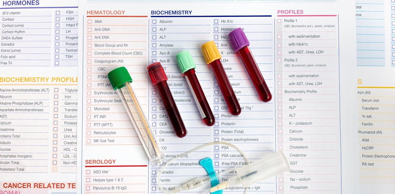Diferenças entre Exame de Sangue e PCR para ISTs