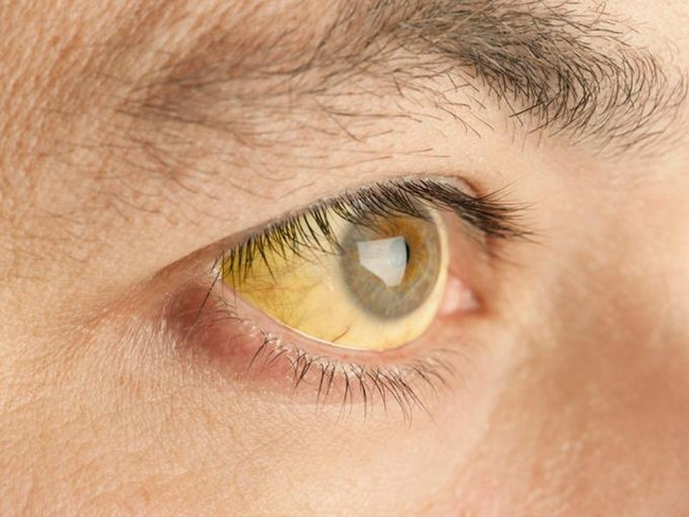 prevenção contra febre amarela