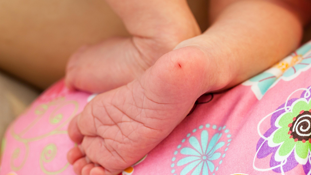 alimentos permitidos fenilcetonúria