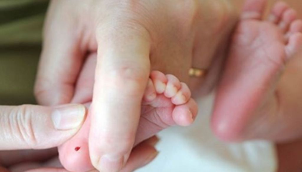 dieta para fenilcetonúricos