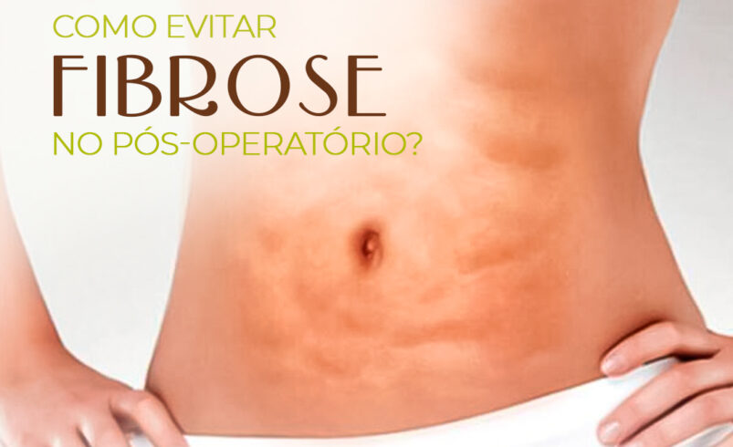 5 ideias de títulos:
1. Fibrose Pós-Cirúrgica: Entenda os Sintomas e Como Prevenir
2. Lipoaspiração e Abdominoplastia: Os Riscos da Fibrose e Soluções
3. Drenagem Linfática e Fisioterapia: Aliados no Combate à Fibrose
4. Fibrose: Quando se Preocupar e Como Agir no Pós-Operatório
5. Guia Completo: Prevenção e Tratamento da Fibrose Pós-Cirúrgica
