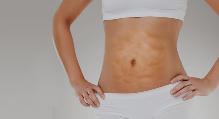 5 ideias de títulos:
1. Fibrose Pós-Cirúrgica: Entenda os Sintomas e Como Prevenir
2. Lipoaspiração e Abdominoplastia: Os Riscos da Fibrose e Soluções
3. Drenagem Linfática e Fisioterapia: Aliados no Combate à Fibrose
4. Fibrose: Quando se Preocupar e Como Agir no Pós-Operatório
5. Guia Completo: Prevenção e Tratamento da Fibrose Pós-Cirúrgica