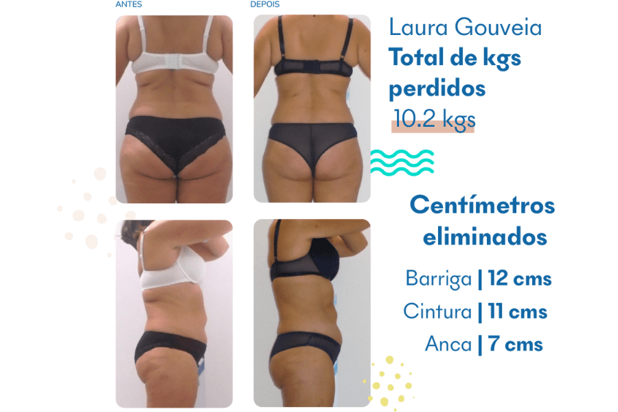 O que é Criolipólise e como funciona?