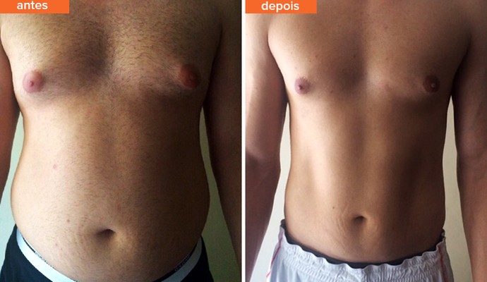 Riscos e Mitos do Gelo na Barriga