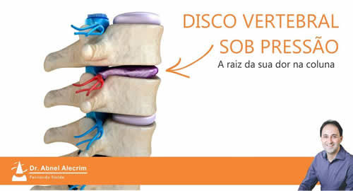 Pilates e Fortalecimento do Core: Aliados no Tratamento da Hérnia de Disco