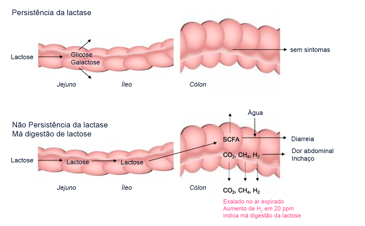 Intolerância à Lactose em Bebês: Como Identificar e Cuidar