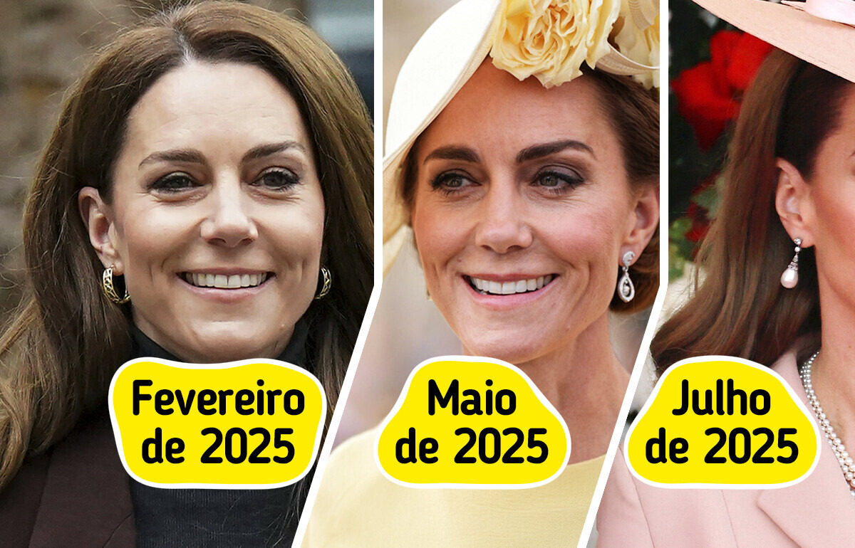 kate middleton antes e depois