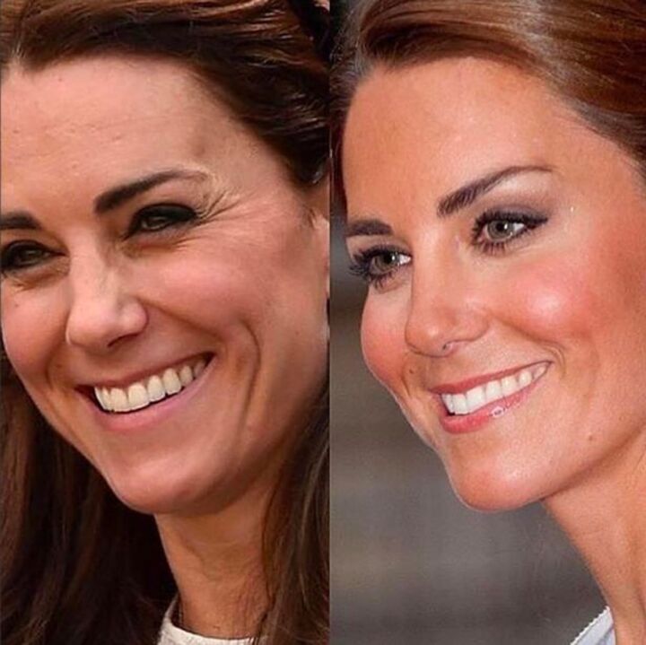 kate middleton antes e depois