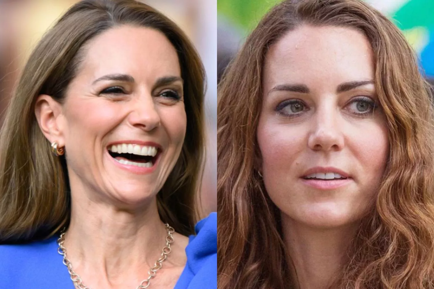 kate middleton antes e depois