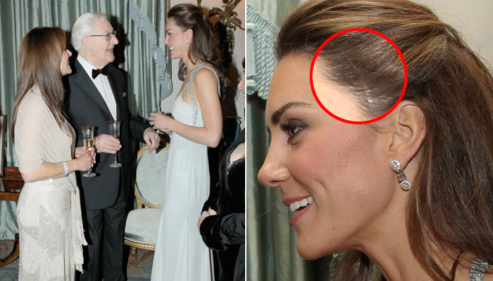 kate middleton antes e depois