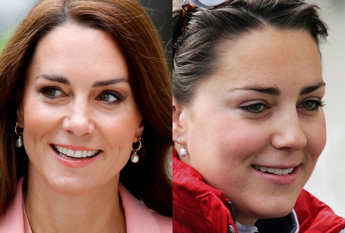 5 ideias de títulos:
1. A Transformação de Kate Middleton: Do Estilo Casual à Elegância Real
2. Cabelo de Kate Middleton: A Camaleoa que Surpreendeu o Público
3. O Impacto do Câncer na Saúde e Aparência de Kate Middleton
4. Vida Pessoal de Kate Middleton: Antes e Depois da Família Real
5. Kate Middleton: Uma Análise Detalhada de sua Evolução Estilística e Pessoal