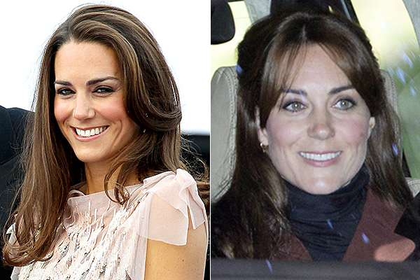 kate middleton antes e depois
