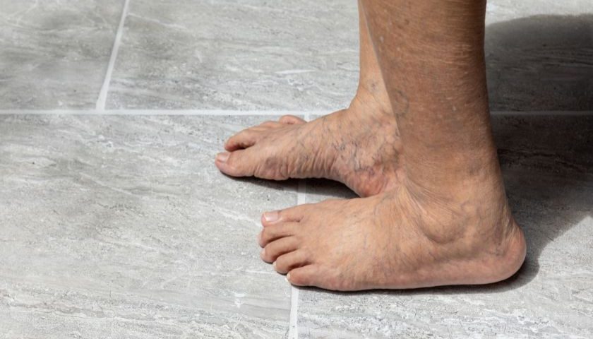 5 ideias de títulos:
1. Má Circulação: Entenda os Sintomas e Causas
2. Como Melhorar a Circulação Sanguínea em Casa
3. Prevenção da Má Circulação: Dicas Essenciais
4. Os Perigos da Má Circulação e Quando Procurar um Médico
5. Doppler Vascular: O Exame Chave para Diagnóstico da Má Circulação