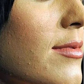 Guia Completo de Primers: Qual o Ideal para Sua Pele?