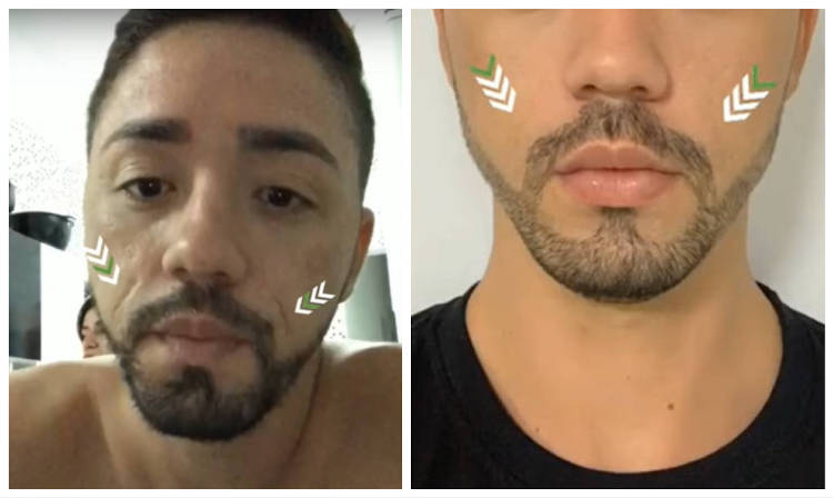 beneficios do mel no rosto