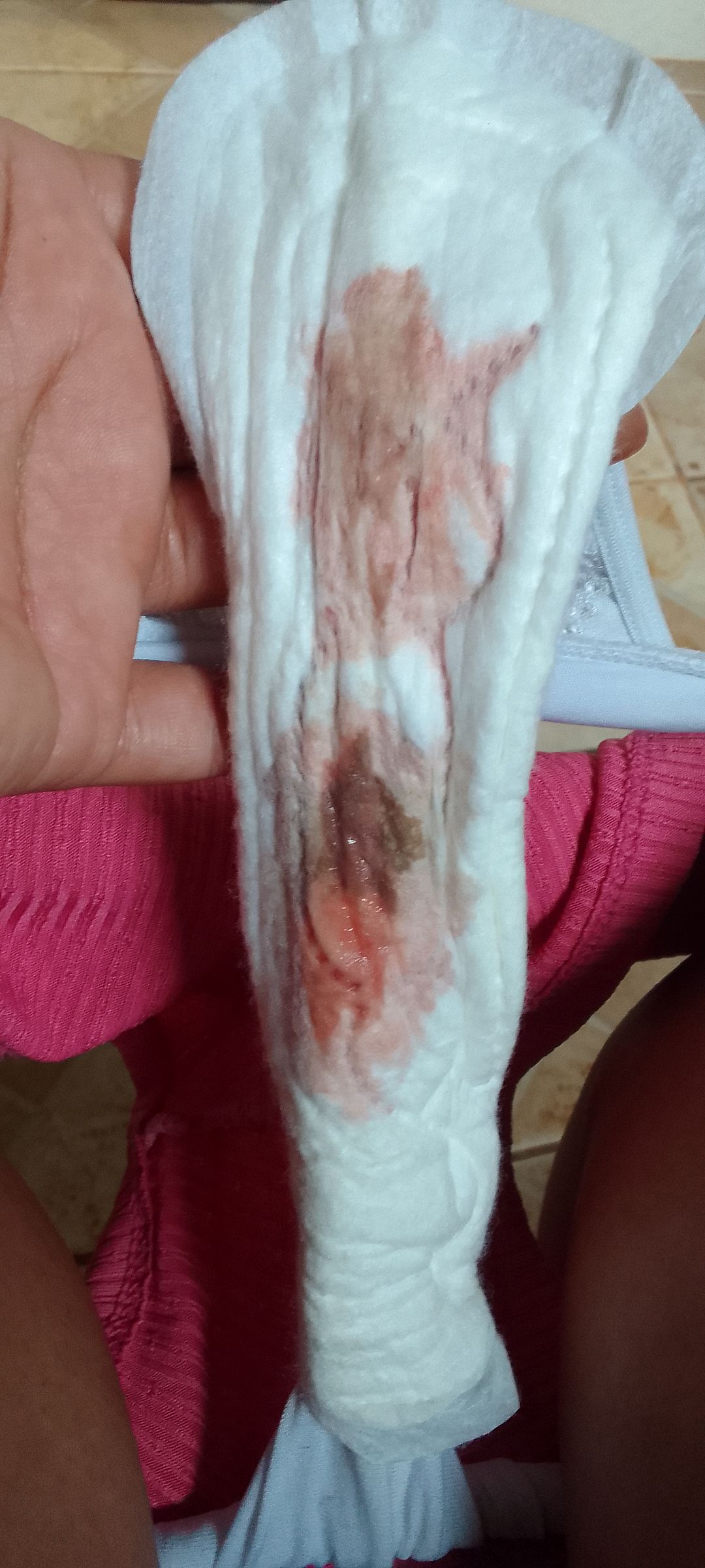 menstruação rosada e pouca