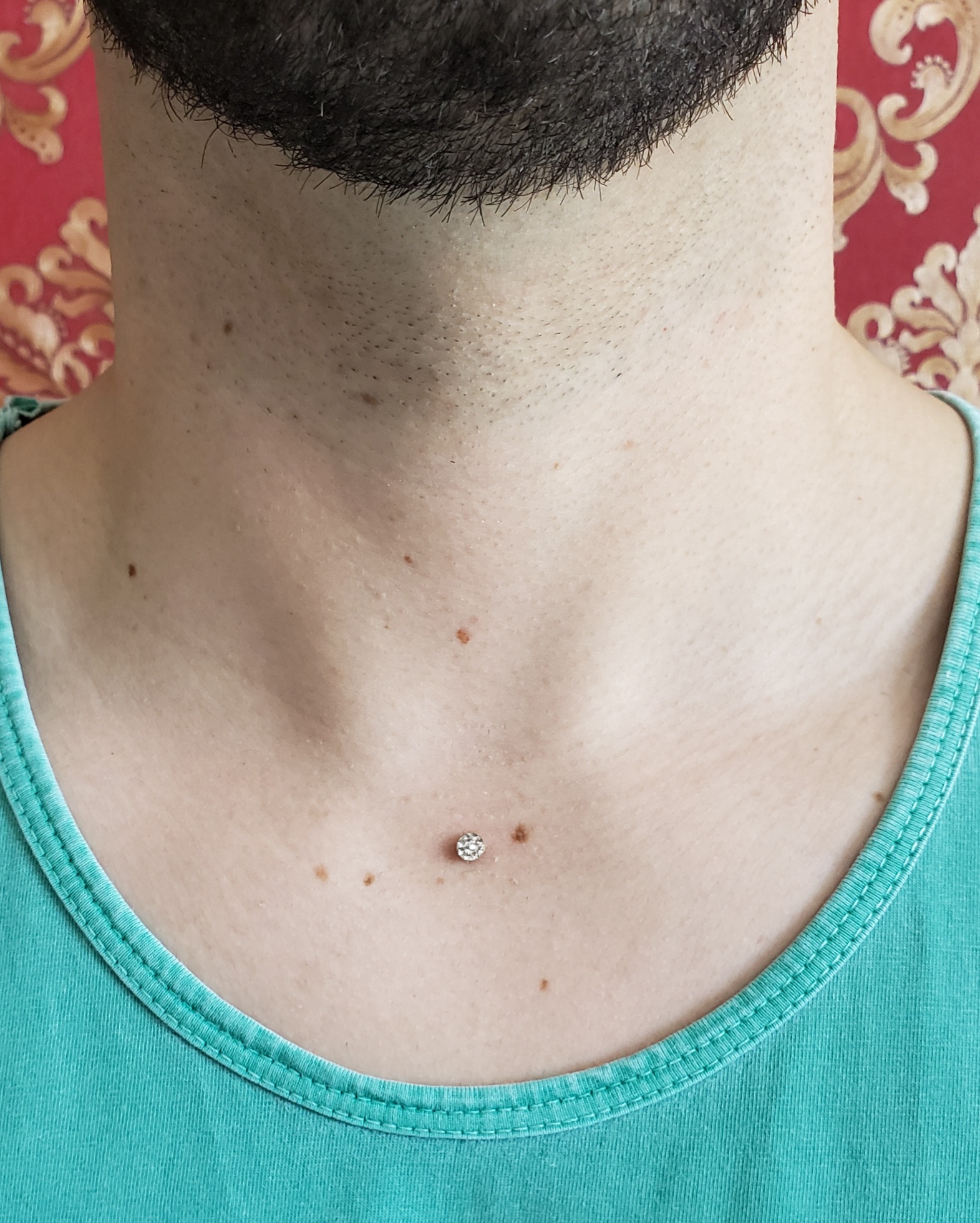 Microdermal Cicatrização