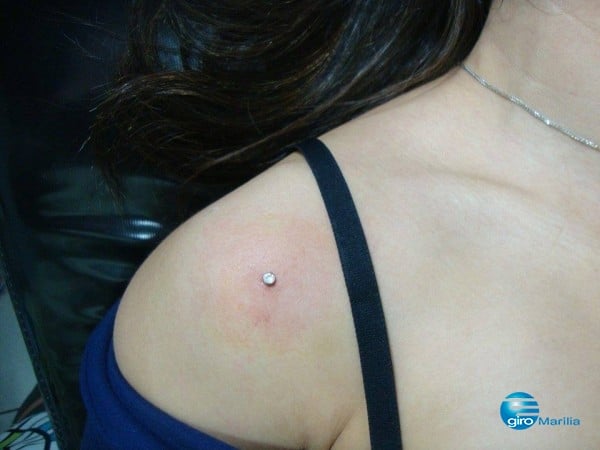 Microdermal dói? Mitos e Verdades sobre a Perfuração