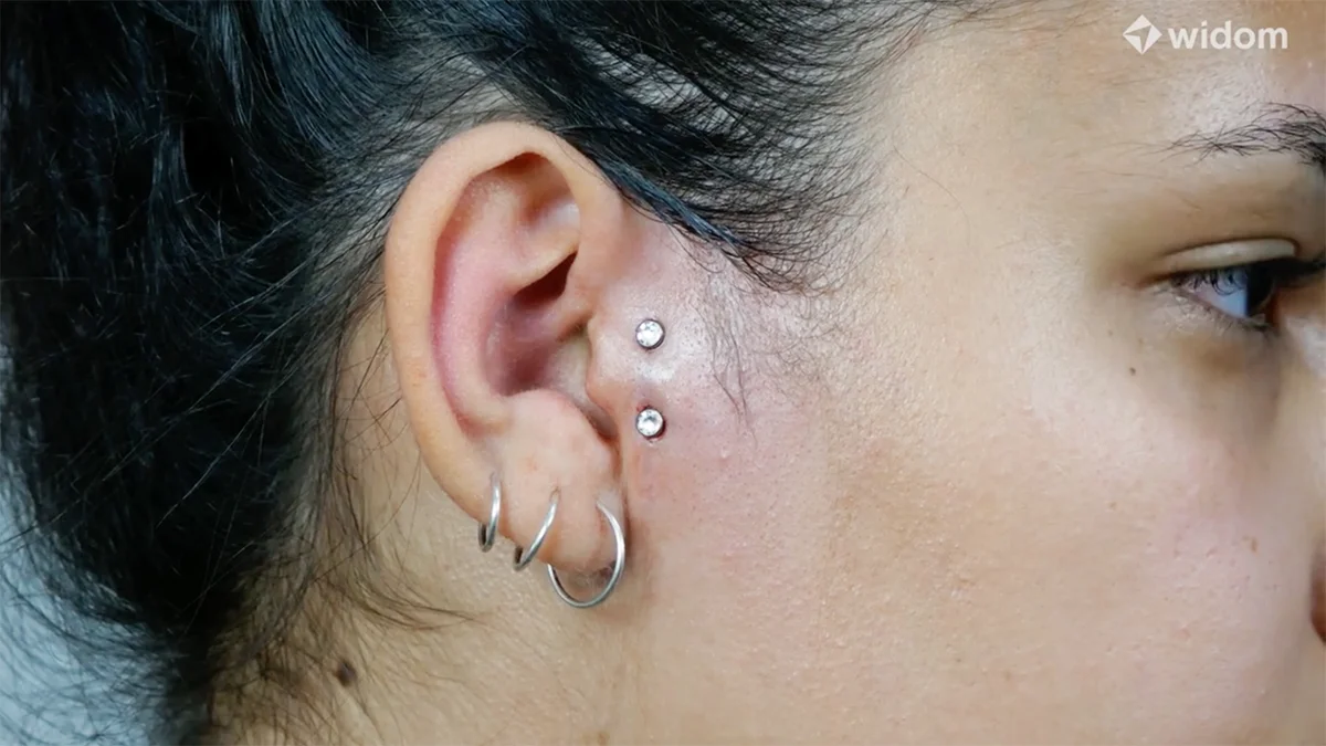 microdermal no rosto