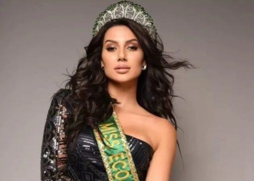 Logina Salah: Quebrando Padrões no Miss Universo com Vitiligo
