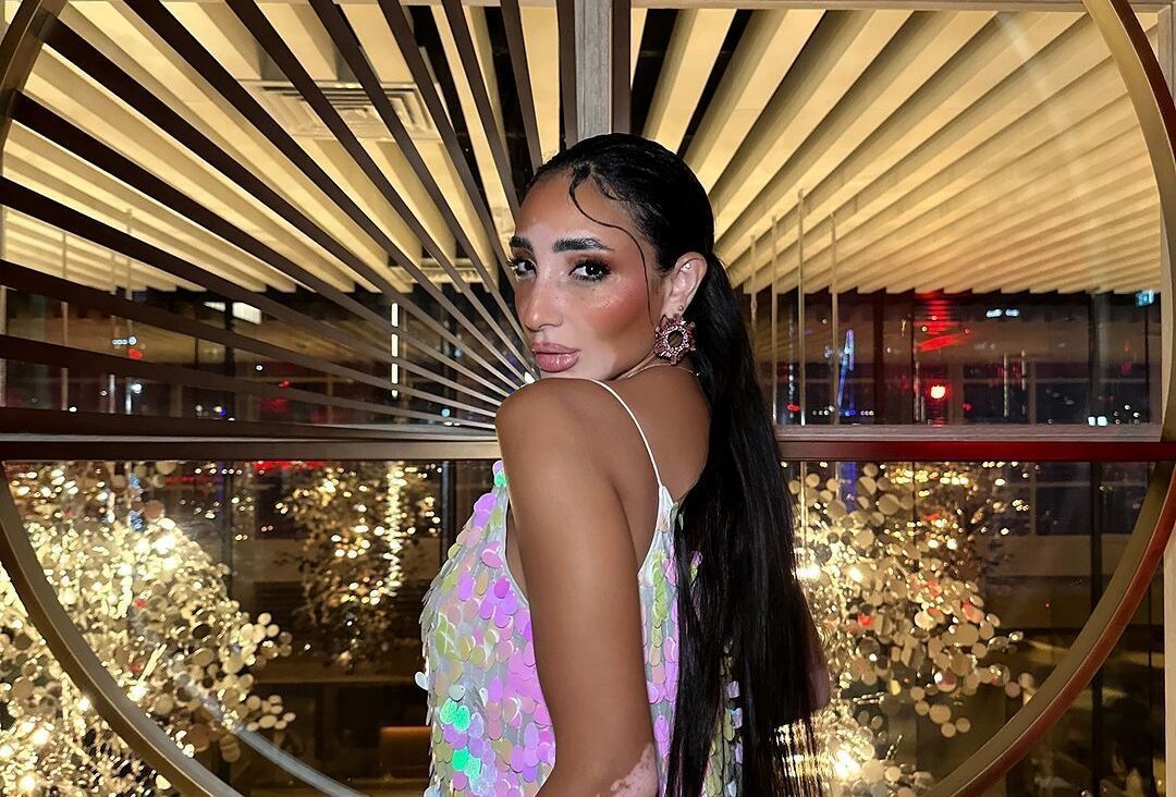 Logina Salah: Quebrando Padrões no Miss Universo com Vitiligo