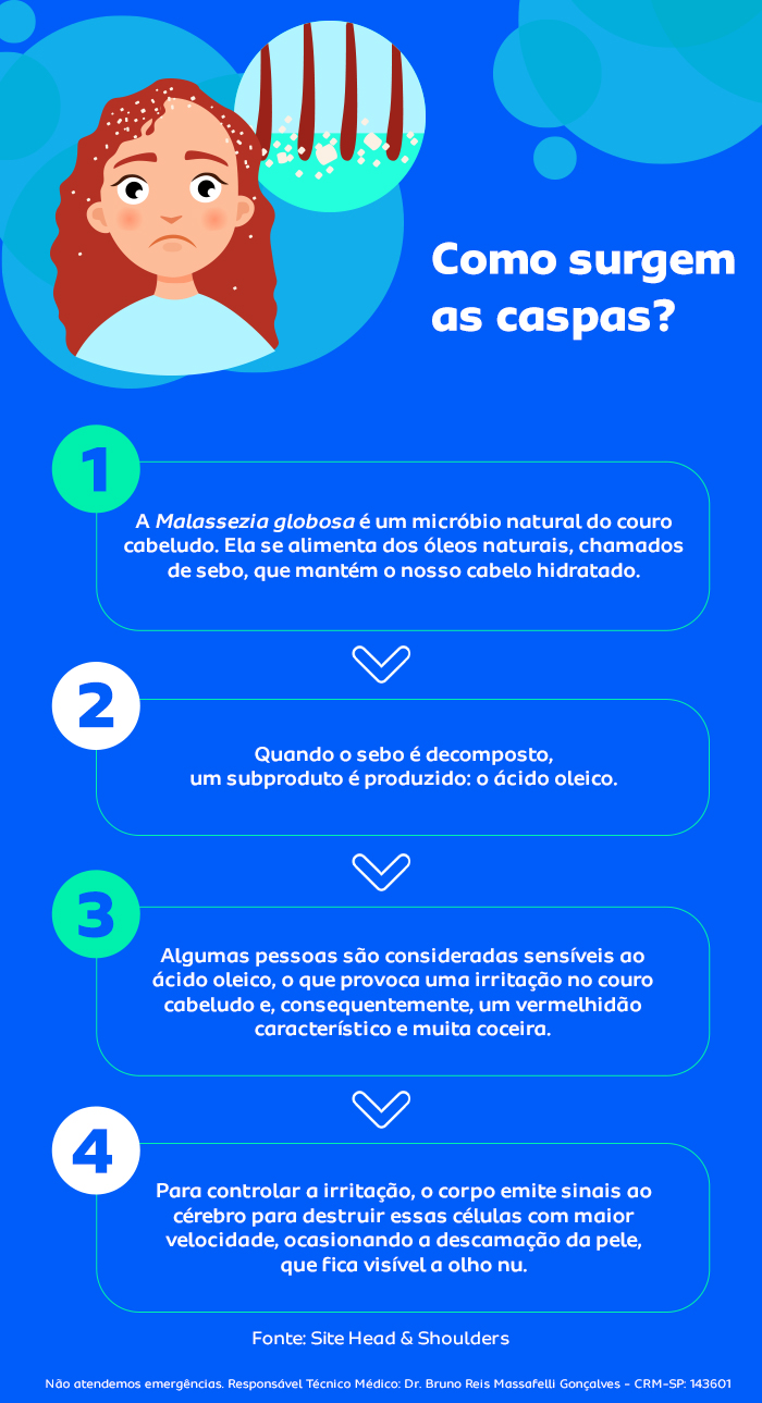 Dicas de Higiene Capilar para Prevenir e Tratar a Caspa