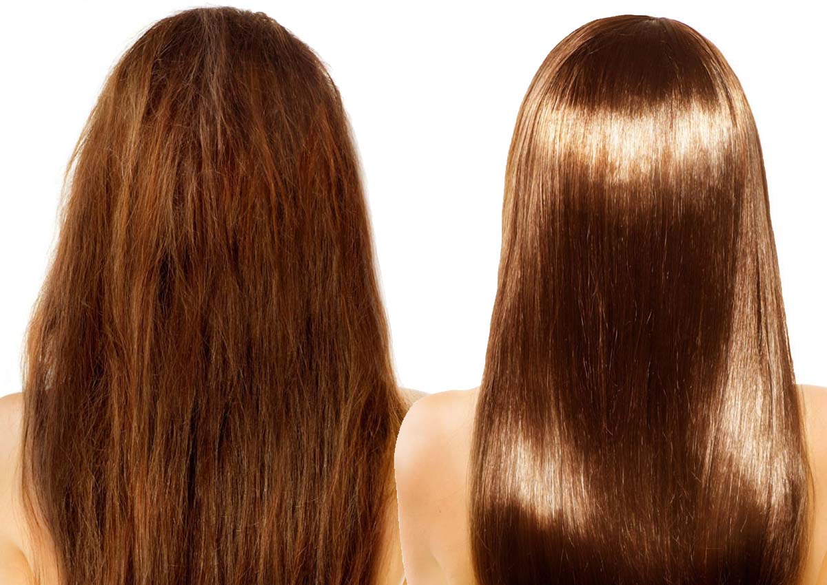 Como funciona a eletrocauterização?