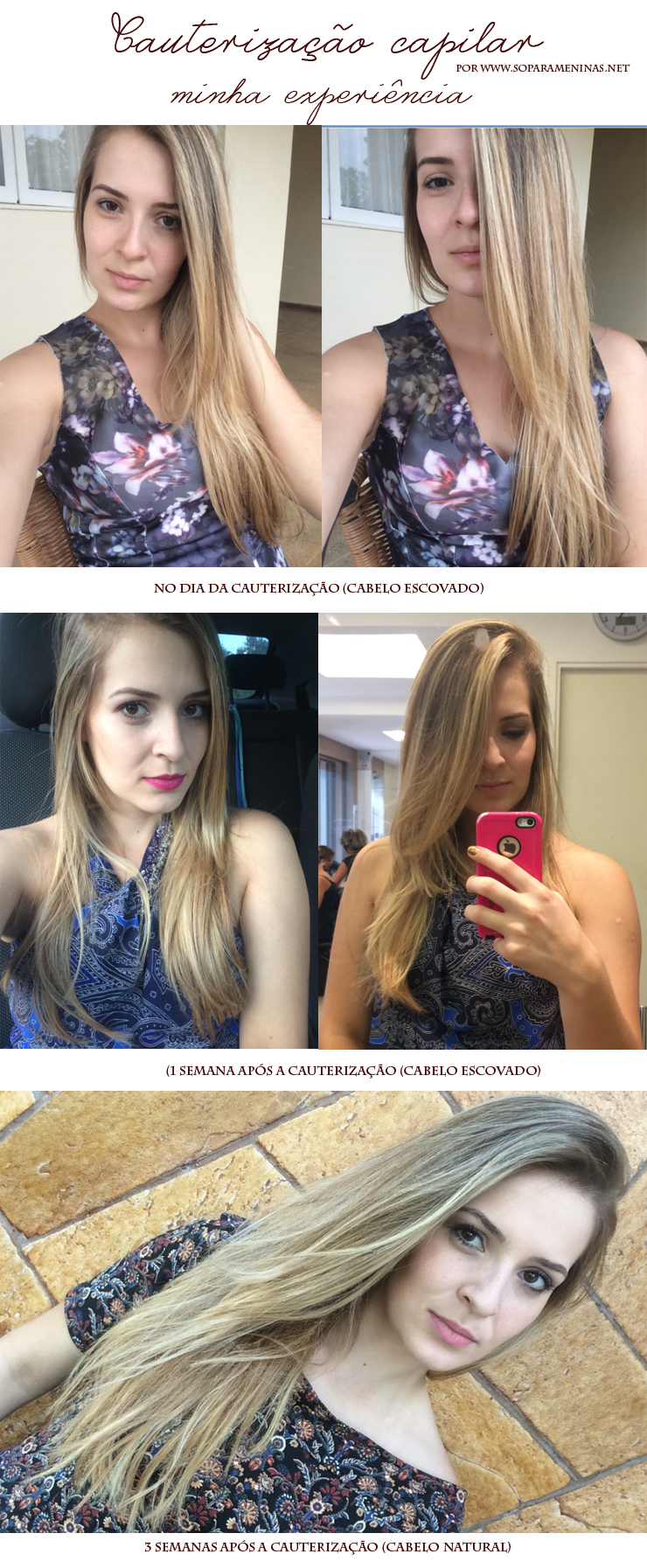 Como funciona a eletrocauterização?