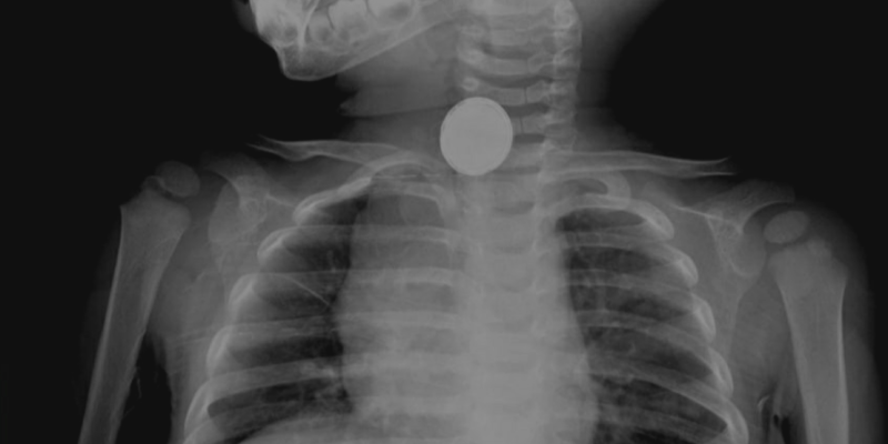 De Esferas de Pedra a Mecanismos Antigos: A Fascinação pelos OOPArts