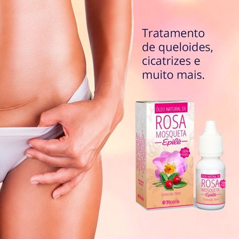 Óleo de Rosa Mosqueta Epilê: Guia Completo de Benefícios e Aplicações