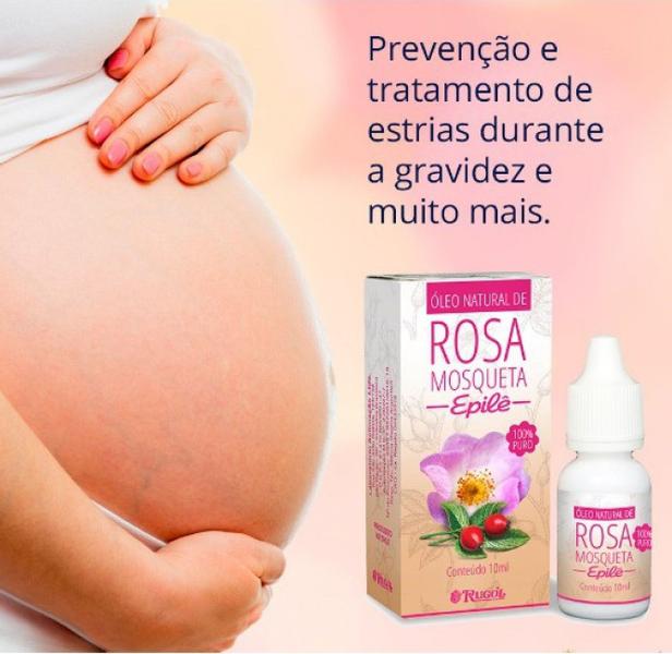 Onde Comprar Óleo de Rosa Mosqueta Epilê: Preços e Lojas
