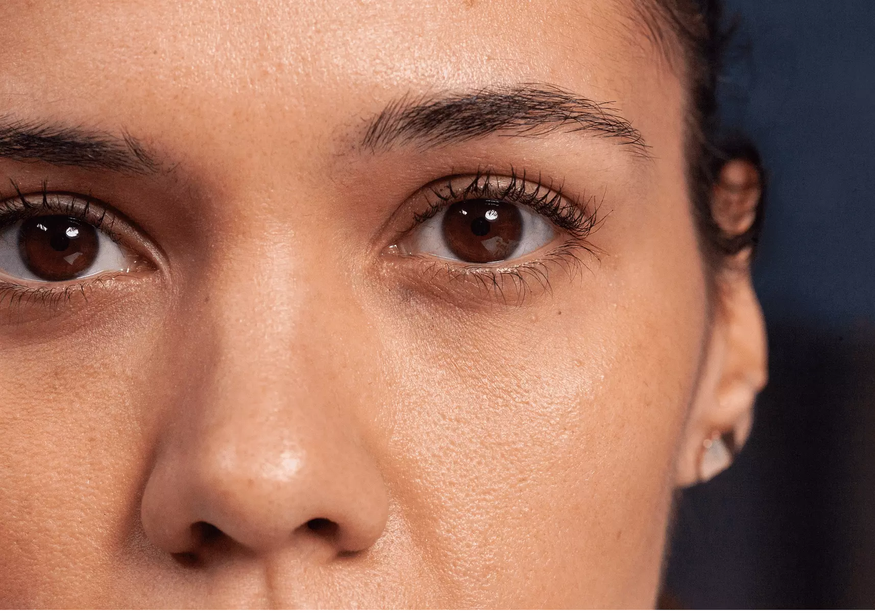 Soluções Caseiras para Olheiras: Mitos e Verdades sobre Chá-Verde e Massagens