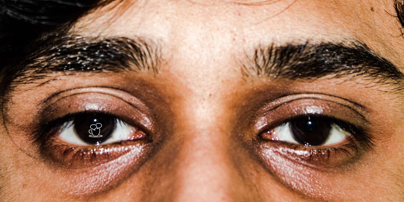 Dermocosméticos para Olheiras: Os Melhores Ativos (Vitamina C, Retinol, Niacinamida)