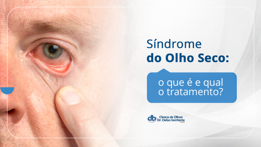 Guia Completo: Como Identificar e Tratar a Síndrome do Olho Seco; Olho Seco e Telas: Entenda a Conexão e Previna-se; Alívio Imediato para Olhos Secos: Dicas e Tratamentos Eficazes; Doenças Autoimunes e Olho Seco: O Que Você Precisa Saber; Lágrimas Artificiais e Higiene Palpebral: Soluções para o Olho Seco